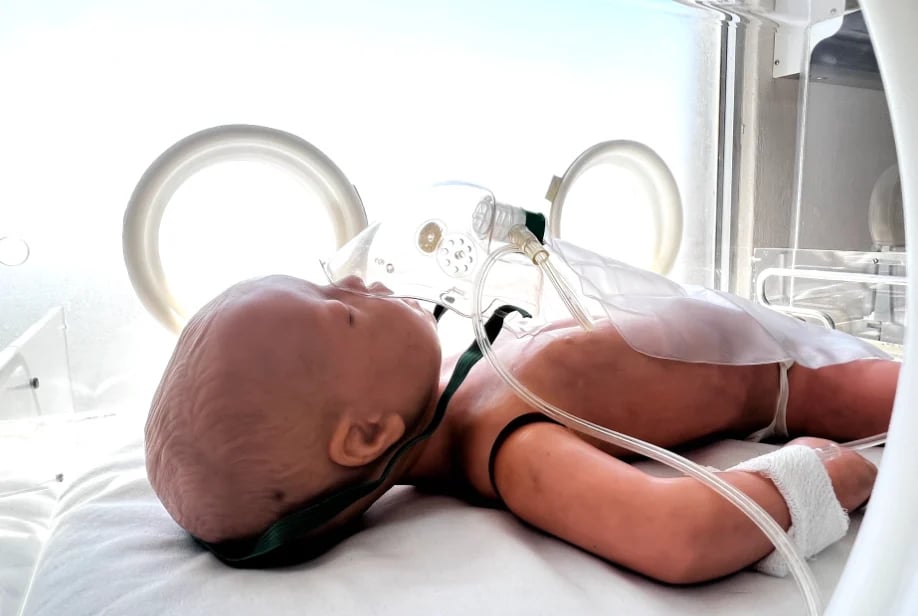 Newborn baby lying in an infant incubator with medical monitoring equipment visible in a hospital setting
